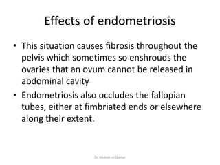 Effects of endometriosis
• This situation causes fibrosis throughout the
pelvis which sometimes so enshrouds the
ovaries t...