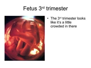 Fetus 3 rd  trimester <ul><li>The 3 rd  trimester looks like it’s a little crowded in there </li></ul>