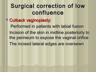 Feminizing genitoplasty in CAH patients | PPT