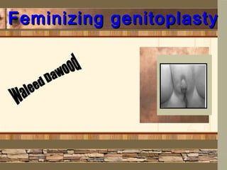 Feminizing genitoplastyFeminizing genitoplasty
Delete text and
place photo here.
 