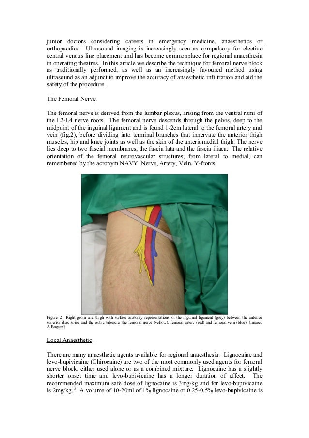 Femoral Nerve Block – A Guide for Medial Students and Junior Doctors.