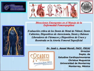 FEMORAL ARTERY : STATE OF THE ART OF ENDOVASCULAR THERAPY