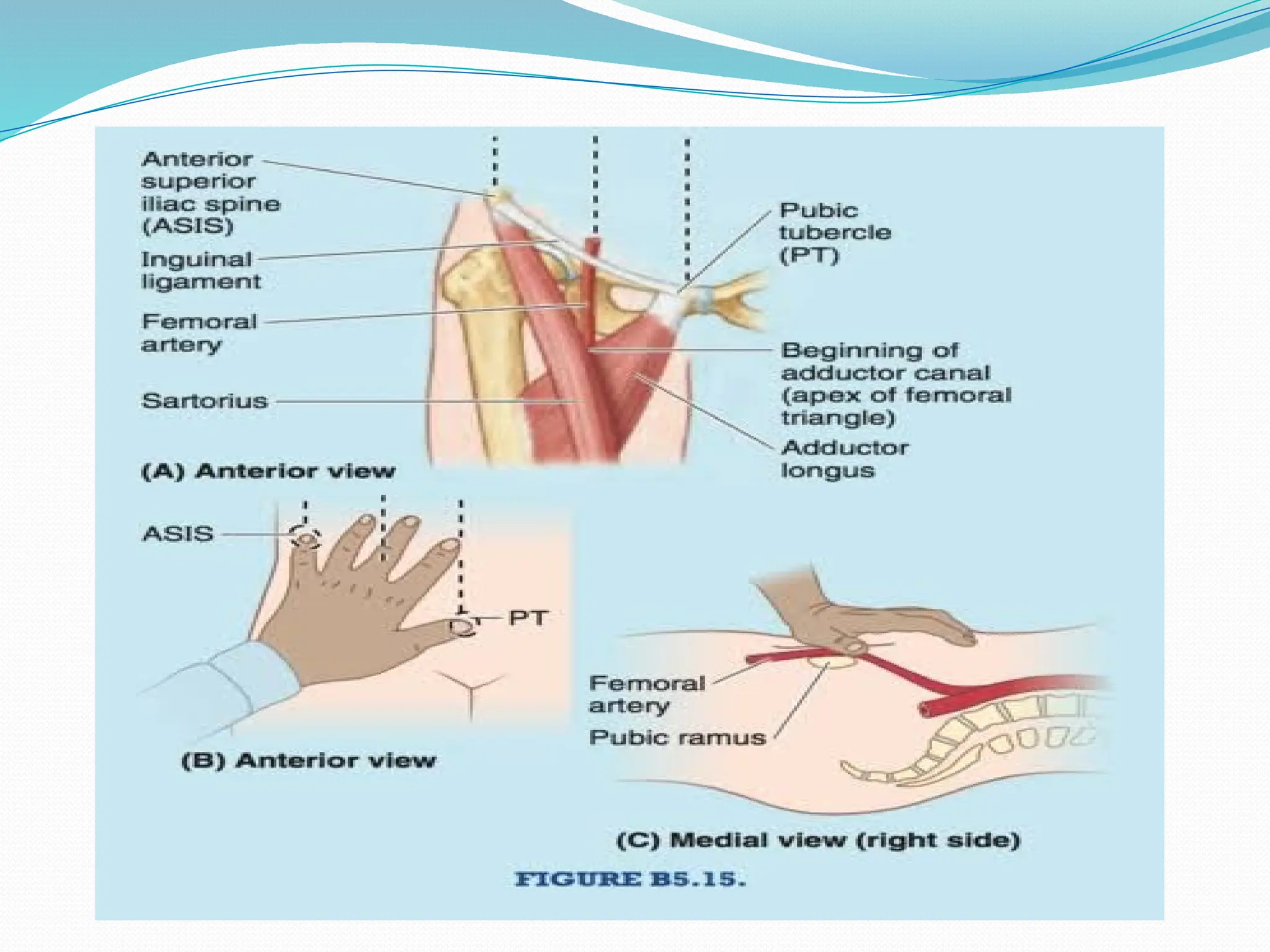 Femoral Artery Access For Catheterization Procedureure pptx Femoral Artery Access For Catheterization Procedureure pptx