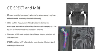 femoral bone assessment.pptx