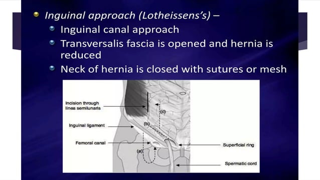 Femoral hernia.pptx surgical diseases .... | PPT