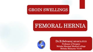 Dr.B.Selvaraj MS;MCh;FICS
Professor of Surgery
Melaka Manipal Medical college
Melaka Malaysia 75150
GROIN SWELLINGS
FEMORAL HERNIA
 