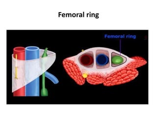 Femoral hernia lec to 1st year | PPTX