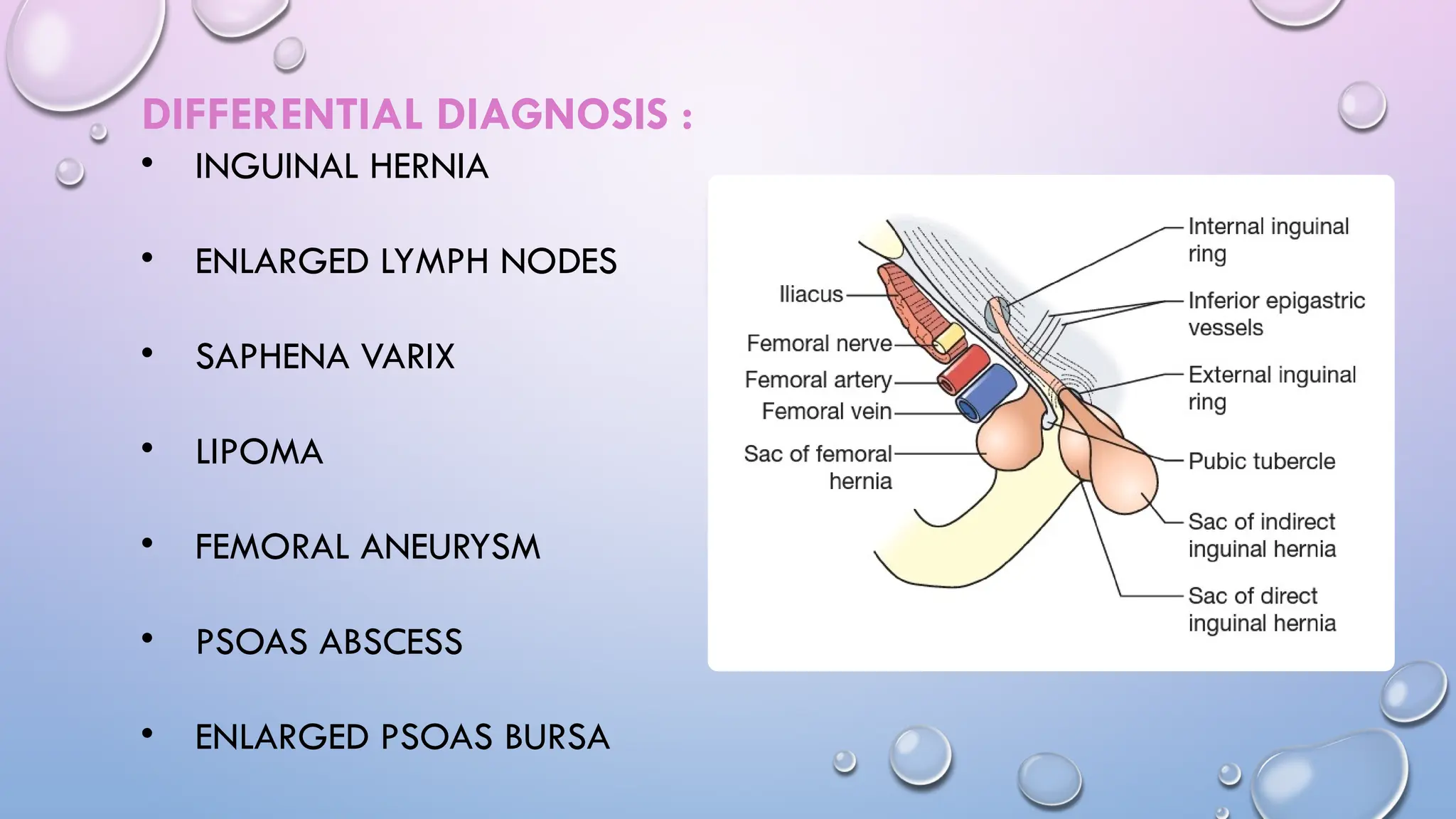 femoral-hernia-by-dr-a-sakthi-thangavel-pptx