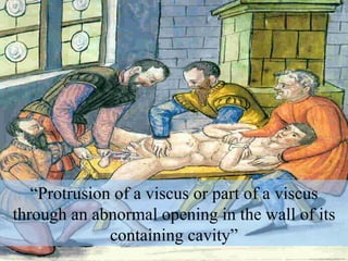 “ Protrusion of a viscus or part of a viscus through an abnormal opening in the wall of its containing cavity” 