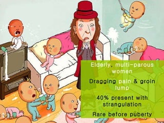 Elderly ,  multi-parous   women Dragging  pain  & groin  lump 40% present with strangulation Rare before puberty 