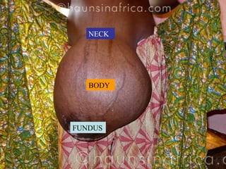 NECK BODY FUNDUS 