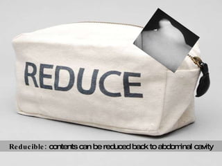 Reducible:  contents can be reduced back to abdominal cavity 
