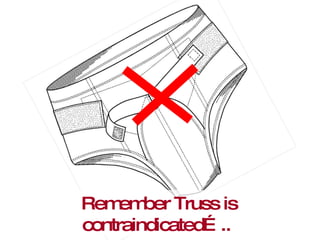 Remember Truss is contraindicated…..  