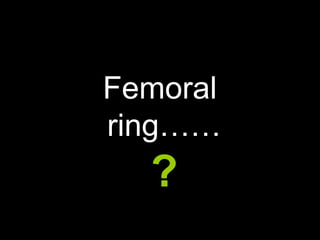 Femoral  ring…… ? 