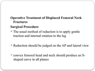 Traction Internal Rotation View Femoral Neck fracture and it's Management | PPTX