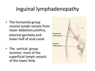 Inguinal lymphadenopathy
• The horizontal group
receive lymph vessels from
lower abdomen,urethra,
external genitalia and
lower half of anal canal.
• The vertical group
receives most of the
superficial lymph vessels
of the lower limb.
 