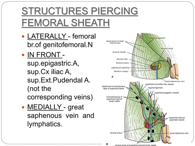 FEMORAL TRIANGLE.ppt | Death, Injury, or Military Conflict | Sensitive ...