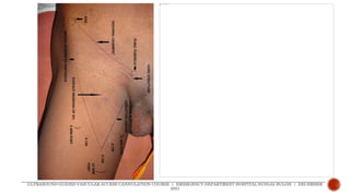 ULTRASOUND-GUIDED VASCULAR ACCESS CANNULATION COURSE | EMERGENCY DEPARTMENT HOSPITAL SUNGAI BULOH | DECEMBER
2021
 