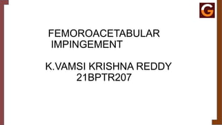 FEMOROACETABULAR
IMPINGEMENT
K.VAMSI KRISHNA REDDY
21BPTR207
 