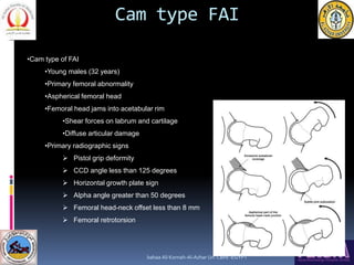 Femoroacetabular impingement (FAI) | PPT