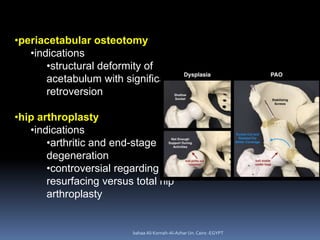 bahaa Ali Kornah-Al-Azhar Un. Cairo -EGYPT
•periacetabular osteotomy
•indications
•structural deformity of
acetabulum with...
