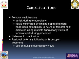 Complications
 Femoral neck fracture
 at risk during femoroplasty
 risk is minimized by limiting depth of femoral
head-...