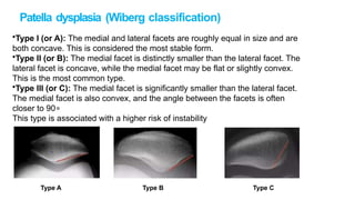 Wiberg Types Femoropatellar instability of knee .pptx