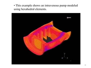 13
• This example shows an intravenous pump modeled
using hexahedral elements.
 