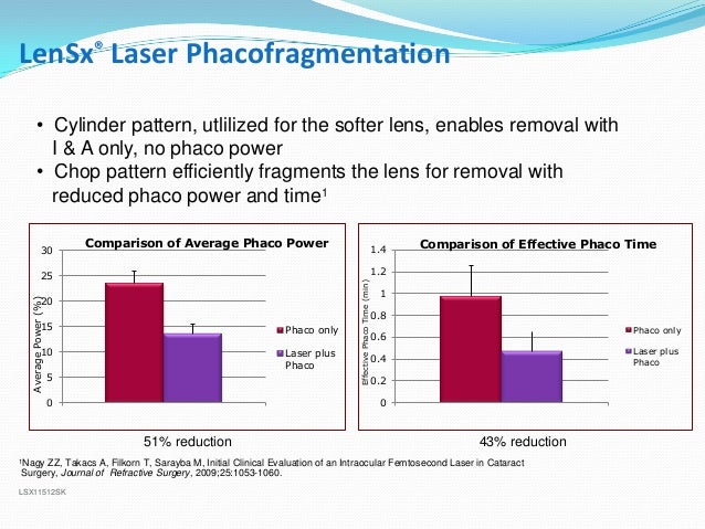 Laser Cataract Surgery