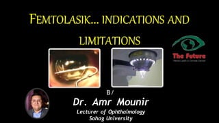B/
Dr. Amr Mounir
Lecturer of Ophthalmology
Sohag University
 