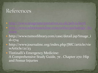  http://www.imageinterpretation.co.uk/pelvis.html
 http://www.wheelessonline.com/ortho/pathologic_fra

cture
 http://www.tumorlibrary.com/case/detail.jsp?image_i
d=1714
 http://www.journalmc.org/index.php/JMC/article/vie
wArticle/21/23
 Tintinalli's Emergency Medicine:
A Comprehensive Study Guide, 7e . Chapter 270: Hip
and Femur Injuries

 