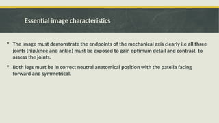 Femur and Hip.ppt positioning of femur & | PPTX