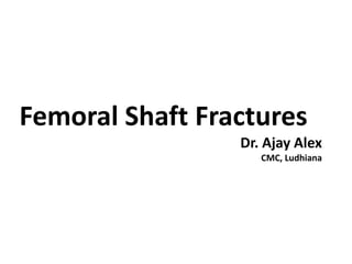Femoral Shaft Fractures
Dr. Ajay Alex
CMC, Ludhiana
 