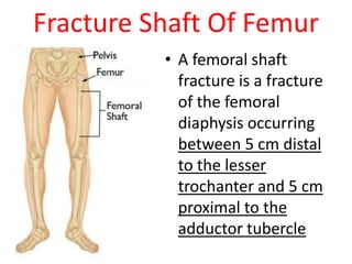 Fracture Shaft Of Femur
• A femoral shaft
fracture is a fracture
of the femoral
diaphysis occurring
between 5 cm distal
to the lesser
trochanter and 5 cm
proximal to the
adductor tubercle
 