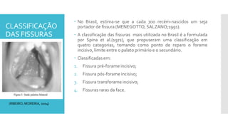 CLASSIFICAÇÃO
DAS FISSURAS
 No Brasil, estima-se que a cada 700 recém-nascidos um seja
portador de fissura (MENEGOTTO, SALZANO;1991).
 A classificação das fissuras mais utilizada no Brasil é a formulada
por Spina et al.(1972), que propuseram uma classificação em
quatro categorias, tomando como ponto de reparo o forame
incisivo, limite entre o palato primário e o secundário.
 Classificadas em:
1. Fissura pré-forame incisivo;
2. Fissura pós-forame incisivo;
3. Fissura transforame incisivo;
4. Fissuras raras da face.
(RIBEIRO; MOREIRA, 2004)
 