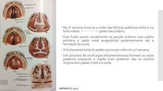  Na 7ª semana inicia-se a união das lâminas palatinas entre si na
linha média palato secundário;
 Esta fusão ocorre inicialmente na porção anterior com palato
primário e septo nasal progredindo posteriormente até a
formação da úvula;
 O fechamento total do palato ocorre por volta da 12ª semana;
 Um processo de ossificação intramembranosa formará os ossos
palatinos enquanto a região mais posterior não se ossifica
originando o palato mole e a úvula.
(IMPARATO; 2017)
 