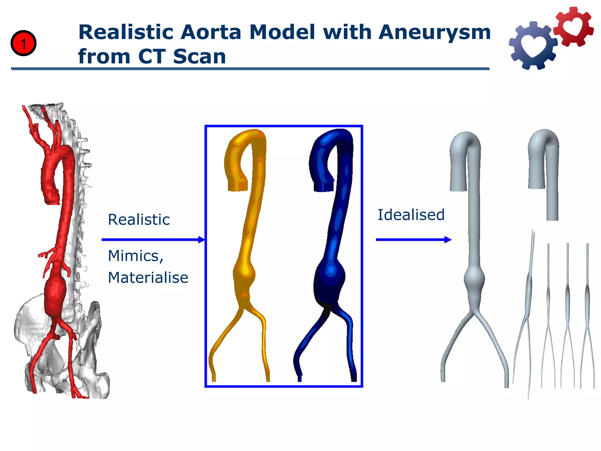 Fluid structure interaction in abdominal aortic aneurysm using ANSYS ...