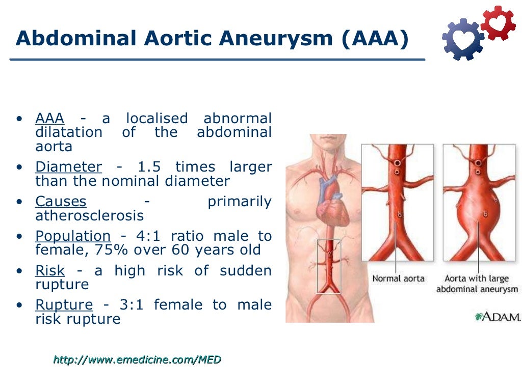 Blood pressure medication for aortic dissection picture