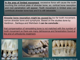 In the area of limited movement, excessive force will cause the tooth
touching the cortical plate of alveolar bone, so, cortical bone resorption
and root penetration will appear. Tooth movement in limited area can
contribute alveolar bone loss and it is still debatable.
Dent. J. Vol. 41. No. 1 January-March 2008: 21-24
Alveolar bone resorption might be caused by too far tooth movement,
narrow alveolar bone and symphysis. Based on the studies done by
Vardimon , Sarikaya and Wehrbein it can be conclude :
that compensation of remodeling bone is not matched with the number of
tooth movement so there are many dehiscence and fenestration found at
the end of orthodontic treatment.
fenestration dehiscence
 