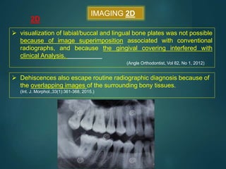IMAGING 2D
2D
 visualization of labial/buccal and lingual bone plates was not possible
because of image superimposition associated with conventional
radiographs, and because the gingival covering interfered with
clinical Analysis.
(Angle Orthodontist, Vol 82, No 1, 2012)
 Dehiscences also escape routine radiographic diagnosis because of
the overlapping images of the surrounding bony tissues.
(Int. J. Morphol.,33(1):361-368, 2015.)
 