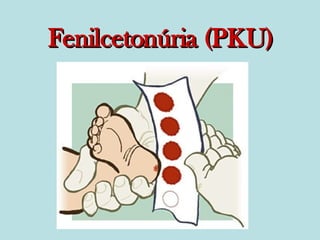 Fenilcetonúria (PKU) 