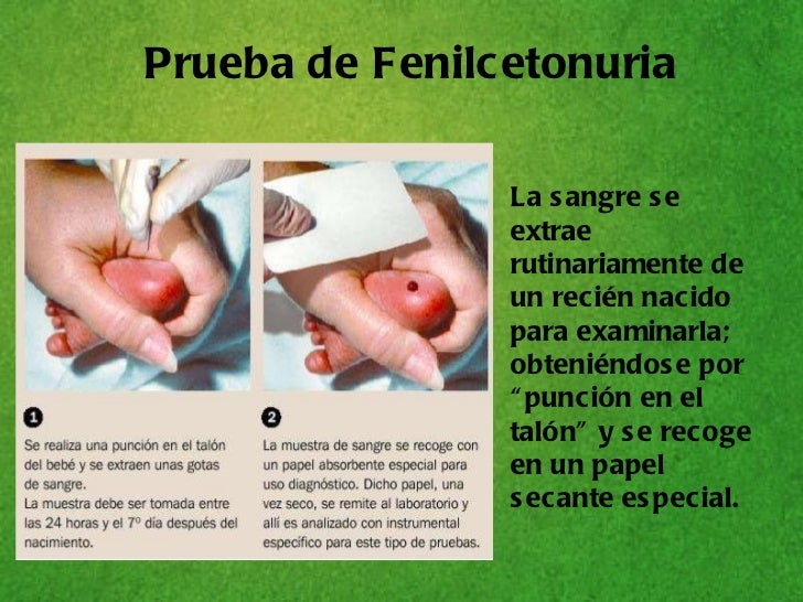 El barniz lotseril el precio en las farmacias