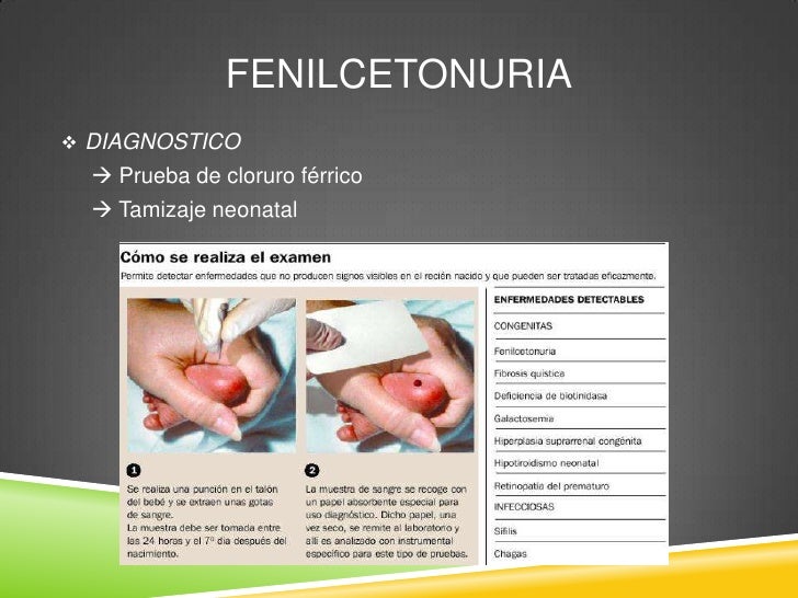 Fenilcetonuria (PKU)