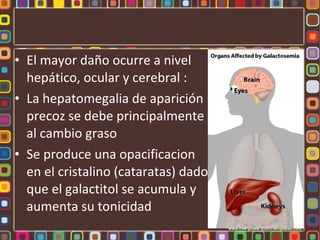 • El mayor daño ocurre a nivel
  hepático, ocular y cerebral :
• La hepatomegalia de aparición
  precoz se debe principalmente
  al cambio graso
• Se produce una opacificacion
  en el cristalino (cataratas) dado
  que el galactitol se acumula y
  aumenta su tonicidad
 