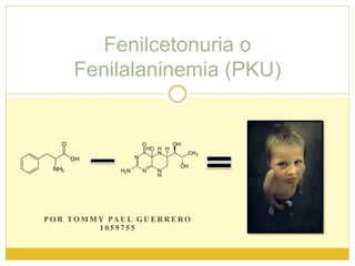 Fenilcetonuria o
Fenilalaninemia (PKU)
P O R TO M M Y PA U L G U E R R E R O
1 0 5 9 7 5 5
 