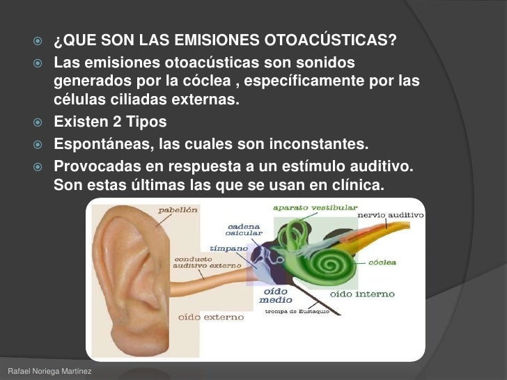 emisiones otoacusticas