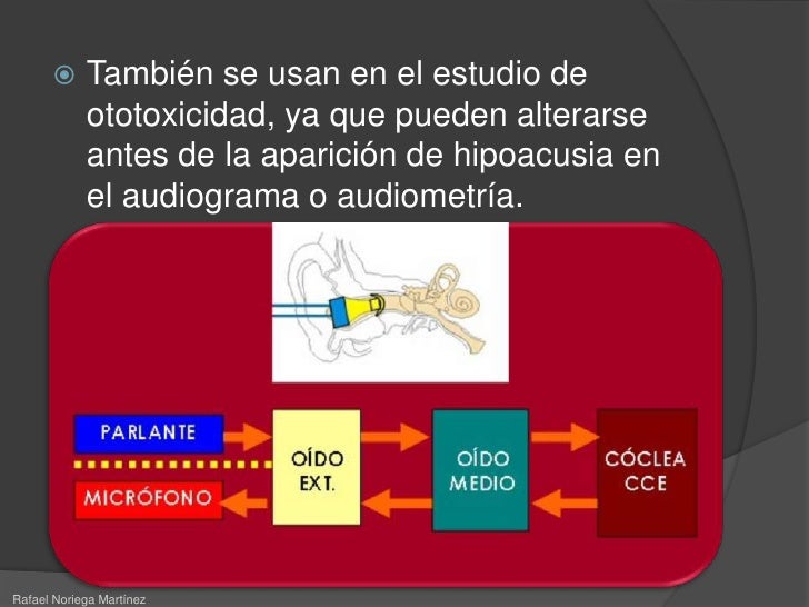 emisiones otoacusticas