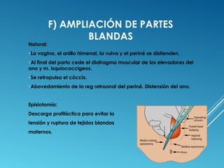 F) AMPLIACIÓN DE PARTES 
BLANDAS 
Natural: 
oLa vagina, el anillo himenal, la vulva y el periné se distienden. 
oAl final del parto cede el diafragma muscular de los elevadores del 
ano y m. isquiococcigeos. 
oSe retropulsa el cóccix. 
oAbovedamiento de la reg retroanal del periné. Distensión del ano. 
Episiotomía: 
Descarga profiláctica para evitar la 
tensión y ruptura de tejidos blandos 
maternos. 
 