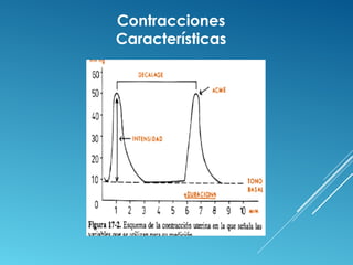 Contracciones 
Características 
 