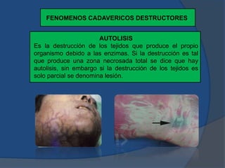 FENOMENOS CADAVERICOS DESTRUCTORES
AUTOLISIS
Es la destrucción de los tejidos que produce el propio
organismo debido a las enzimas. Si la destrucción es tal
que produce una zona necrosada total se dice que hay
autolisis, sin embargo si la destrucción de los tejidos es
solo parcial se denomina lesión.
 